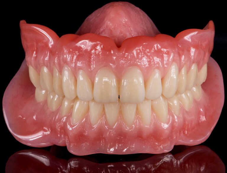 IMG-Case8AfterDentures-c1272.jpg