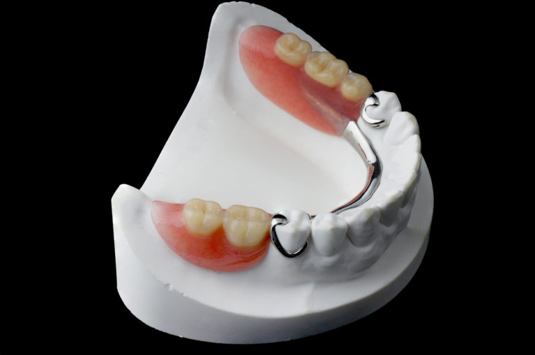Partial-Dentures-768x510-1.jpg