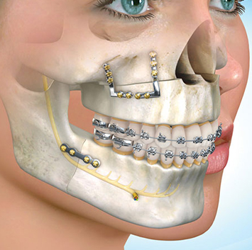 wisdomdental_1